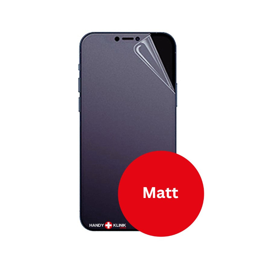 Service Upgrade Displayschutz Hydrogelfolie Matt für Smartphones